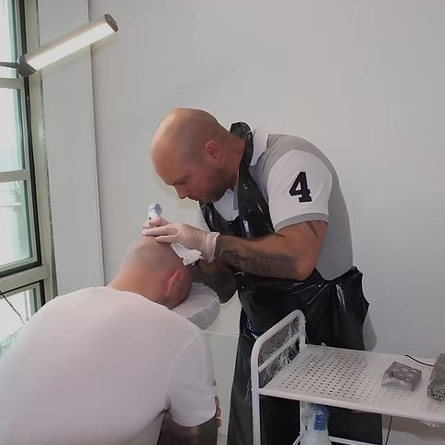 SMP 2 Scalp Micropigmentation (SMP)
